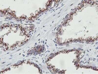 Immunohistochemistry: NMT2 Antibody (OTI1G3) - Azide and BSA Free [NBP2-73021]