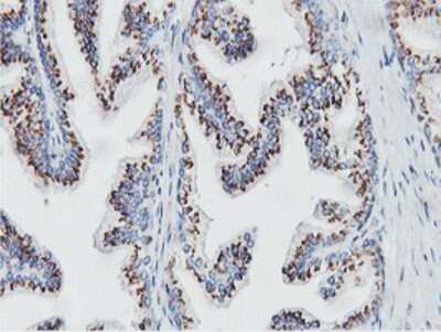 Immunohistochemistry: NMT2 Antibody (OTI1G3) - Azide and BSA Free [NBP2-73021]