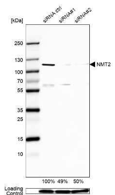 Western Blot: NMT2 Antibody [NBP1-85817]