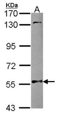 Western Blot: NMT2 Antibody [NBP2-19555]