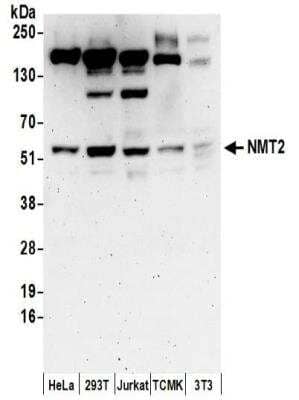 Western Blot: NMT2 Antibody [NBP2-32244]