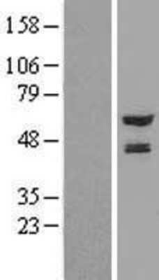 Western Blot: NMT2 Overexpression Lysate [NBL1-13695]