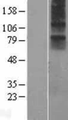 Western Blot: Neuromedin UR1/NMUR1 Overexpression Lysate [NBP2-07672]