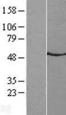 Western Blot: Neuromedin UR2/NMUR2 Overexpression Lysate [NBL1-13698]