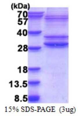 SDS-PAGE: Recombinant Human PMF1-BGLAP His Protein [NBP2-23338]