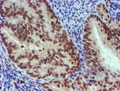 Immunohistochemistry-Paraffin: Nicotinamide N-Methyltransferase/NNMT Antibody (OTI3D8) [NBP2-00537]
