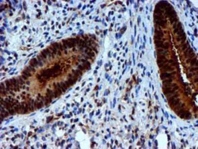 Immunohistochemistry-Paraffin: Nicotinamide N-Methyltransferase/NNMT Antibody (OTI3D8) [NBP2-00537]