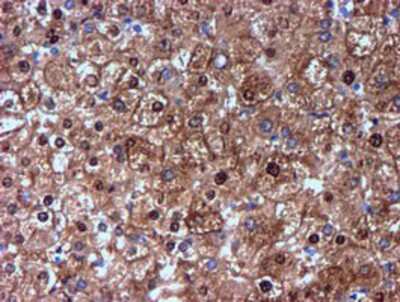 Immunohistochemistry-Paraffin: Nicotinamide N-Methyltransferase/NNMT Antibody (OTI3D8) [NBP2-00537]