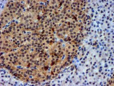 Immunohistochemistry-Paraffin: Nicotinamide N-Methyltransferase/NNMT Antibody (OTI3D8) [NBP2-00537]
