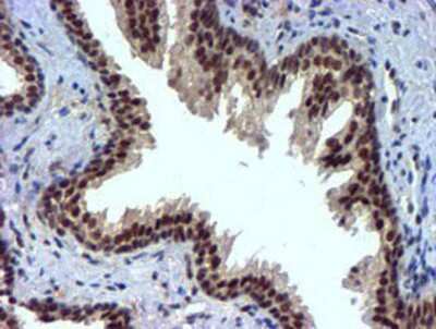 Immunohistochemistry-Paraffin: Nicotinamide N-Methyltransferase/NNMT Antibody (OTI3D8) [NBP2-00537]