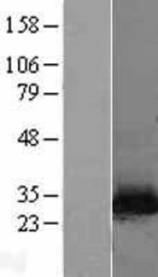 Western Blot: Nicotinamide N-Methyltransferase/NNMT Overexpression Lysate [NBL1-13700]