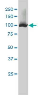 Western Blot: NNT Antibody (1D6) [H00023530-M01]