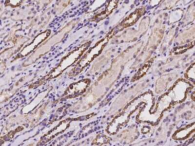 Immunohistochemistry-Paraffin: NNT Antibody [NBP2-98006]