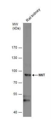 Western Blot: NNT Antibody [NBP1-32109]