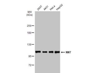 Western Blot: NNT Antibody [NBP1-32109]