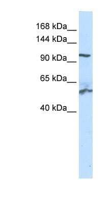 Western Blot: NNT Antibody [NBP1-59612]