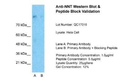 Western Blot: NNT Antibody [NBP1-59612]