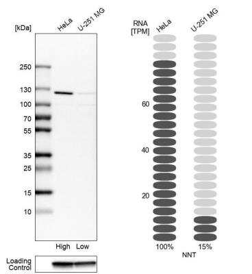 Western Blot: NNT Antibody [NBP1-86512]