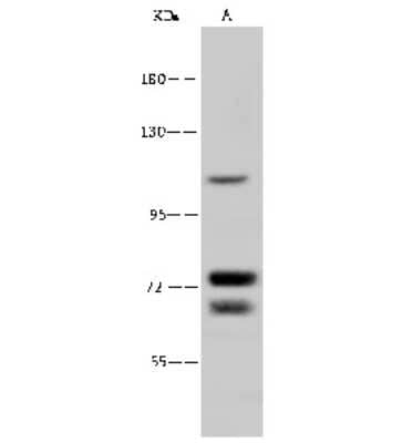 Western Blot: NNT Antibody [NBP2-99302]