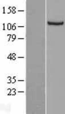 Western Blot: NNT Overexpression Lysate [NBL1-13701]