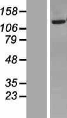 Western Blot: NNT Overexpression Lysate [NBP2-04791]