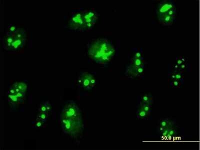Immunocytochemistry/ Immunofluorescence: NO66 Antibody [H00079697-B01P]