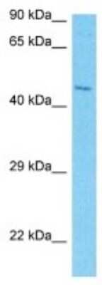 Western Blot: NO66 Antibody [NBP3-09972]