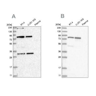 Western Blot: NOA1 Antibody [NBP1-81772]