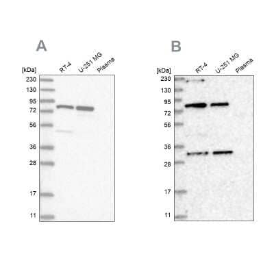 Western Blot: NOA1 Antibody [NBP1-81773]