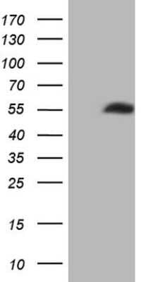 Western Blot: NOB1 Antibody (OTI1C12) [NBP2-46187]