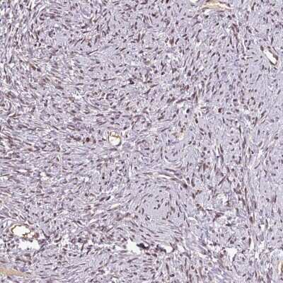 Immunohistochemistry-Paraffin: NOB1 Antibody [NBP2-13663]