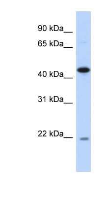 Western Blot: NOB1 Antibody [NBP1-55404]