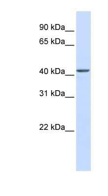 Western Blot: NOB1 Antibody [NBP1-56462]