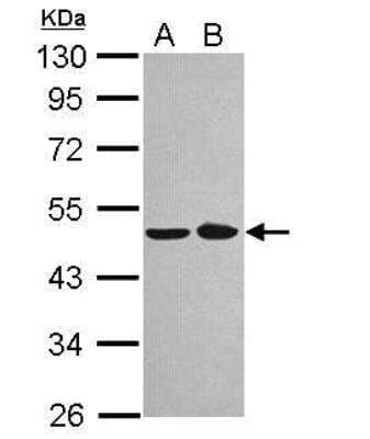 Western Blot: NOB1 Antibody [NBP2-19558]