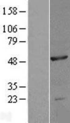 Western Blot: NOB1 Overexpression Lysate [NBL1-13702]