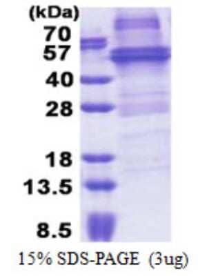 SDS-PAGE: Recombinant Human NOB1 His Protein [NBP2-23288]