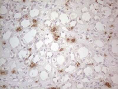 Immunohistochemistry: NOBOX Antibody (OTI4C5) [NBP2-46193]