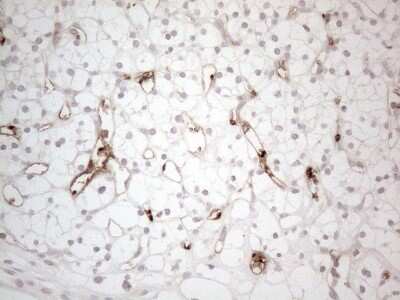 Immunohistochemistry: NOBOX Antibody (OTI4C5) [NBP2-46193]