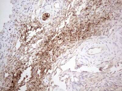 Immunohistochemistry: NOBOX Antibody (OTI4C5) [NBP2-46193]