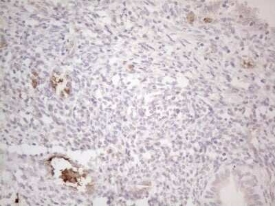 Immunohistochemistry: NOBOX Antibody (OTI4C5) [NBP2-46193]