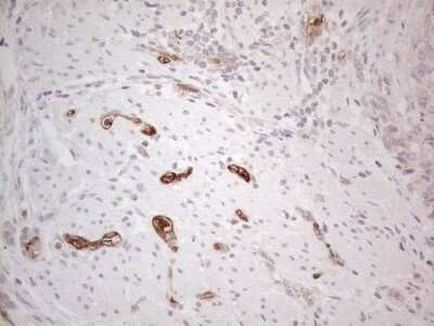 Immunohistochemistry: NOBOX Antibody (OTI4C5) [NBP2-46193]