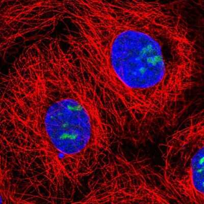 Immunocytochemistry/ Immunofluorescence: NOC3L Antibody [NBP2-56518]