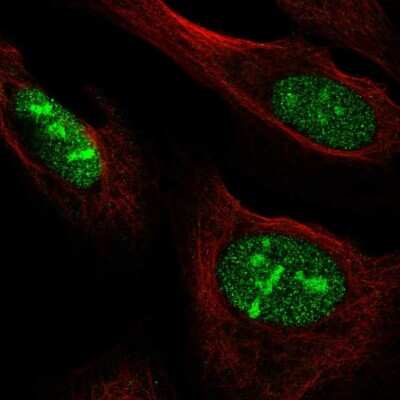 Immunocytochemistry/ Immunofluorescence: NOC3L Antibody [NBP2-58021]