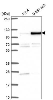 Western Blot: NOC3L Antibody [NBP2-55900]