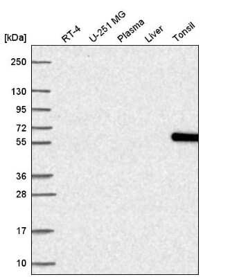 Western Blot: NOC4L Antibody [NBP2-55061]