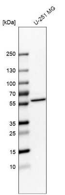 Western Blot: NOC4L Antibody [NBP2-55061]