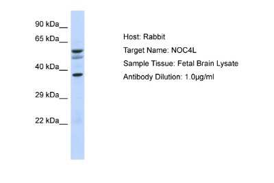 Western Blot: NOC4L Antibody [NBP2-85389]