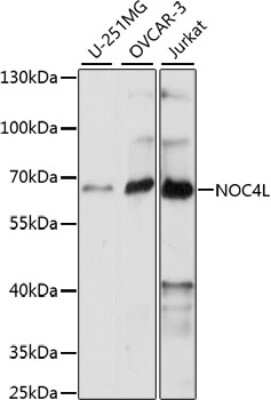 Western Blot: NOC4L AntibodyAzide and BSA Free [NBP2-93101]