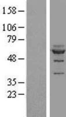 Western Blot: NOC4L Overexpression Lysate [NBL1-13704]