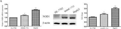 Western Blot: NOD1 Antibody [NB100-56152]